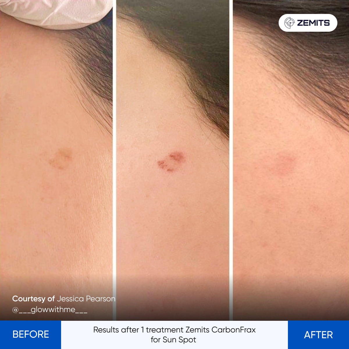 Before After Slide 5